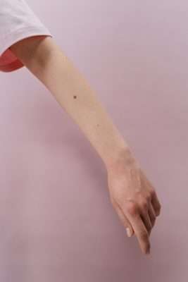 Laser hair removal Dubai arm