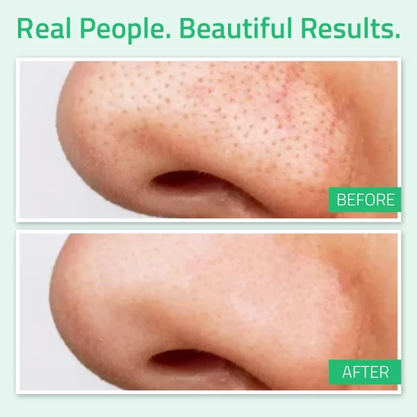 Yeouth brilliant advanced rejuvenating facial toner box pores